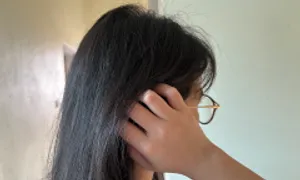 Dấu hiệu mất cân bằng nội tiết tố trên da Dấu hiệu mất cân bằng nội tiết tố trên da