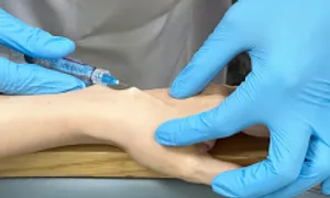 Làm thế nào để bàn tay đầy đặn mềm mại? Làm thế nào để bàn tay đầy đặn mềm mại?